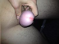 frontal view