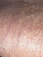 The texture of my foreskin