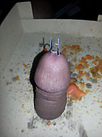 Wax Filling